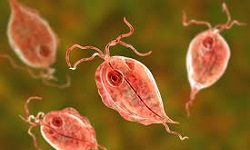 Trichomonas vaginalis